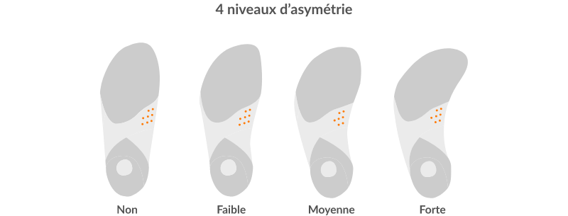 4 niveaux d’asymétrie